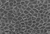 4 - Cellule epitalliche in visione superficiale